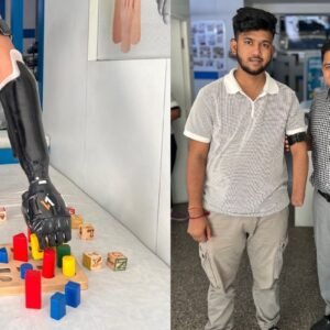 Artificial Limbs for Upper Extremity