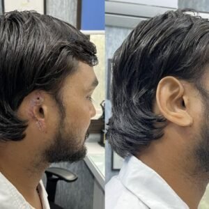 silicone-artificial-ear