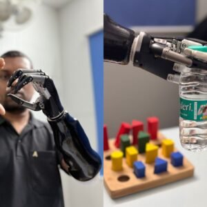 Artificial Limbs for Upper Extremity