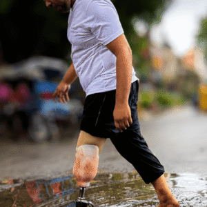 Artificial Limbs for Lower Extremity