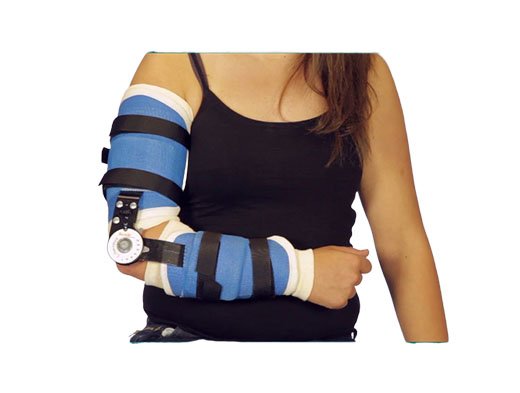 Fracture And Trauma Bracing - Image 5