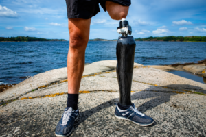 Osseointegration Leg Prosthesis