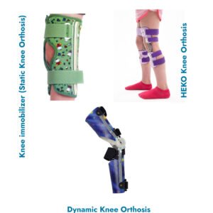 paediatric-ko-knee-orthosis