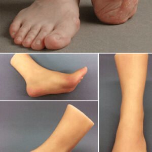 Partial Foot Prosthetics