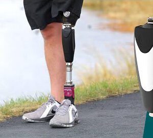 Prosthetic Knees for Artificial Limbs