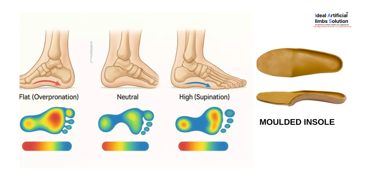 Read more about the article UNDERSTANDING  YOUR GAIT  WITH  FOOT   MAPPING  MAT  AND CUSTOMISED YOUR PERSONALISED   INSOLE FOR PAIN FREE WALKING .