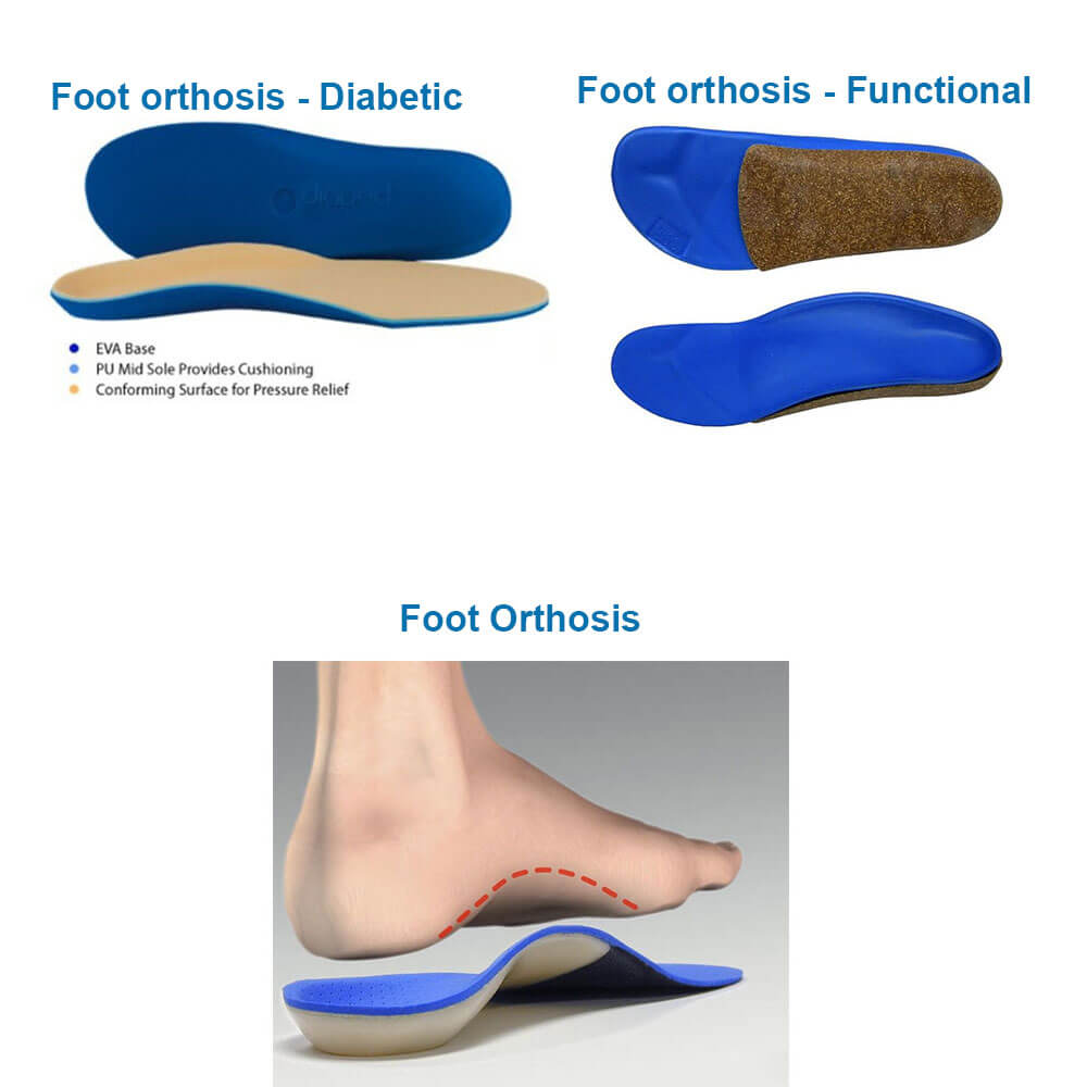 Foot Orthosis (Pre-Fab/Custom/Digitized)