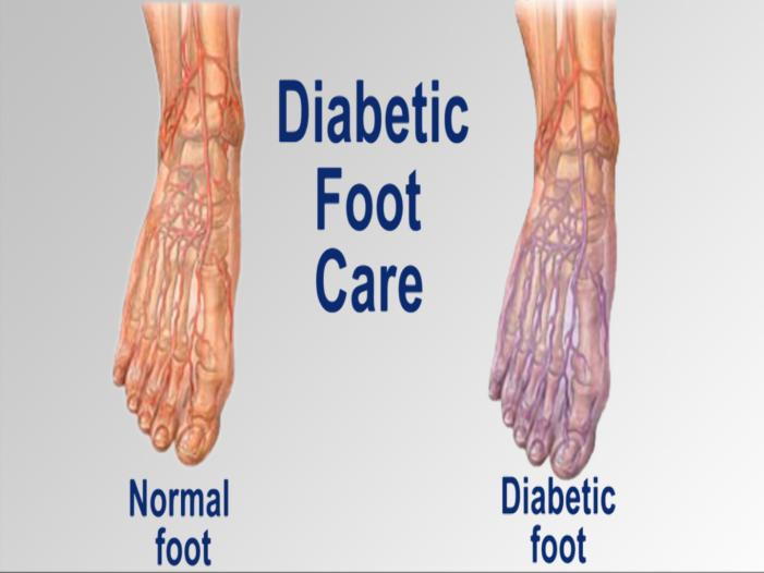 Footcare and Diabetic Solution